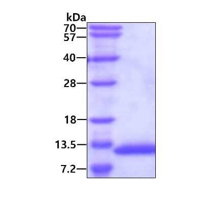 SDS-PAGE Recombinant Human VAMP-5 His Protein